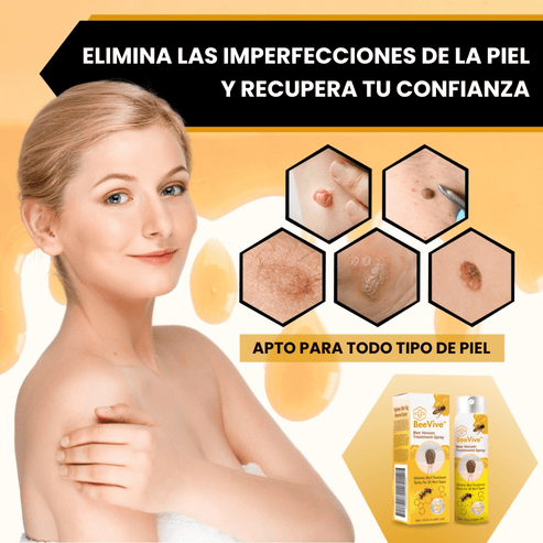 Tratamiento EcoDerm™ | Elimina Verrugas en 7 días